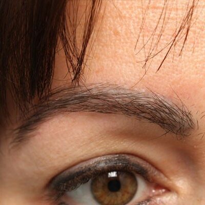 Case-study-Lynsey-aft