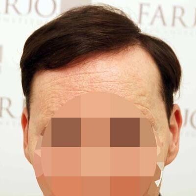 stuart adams after