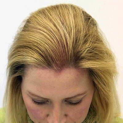 Elaine Nixon after