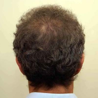 mark black after