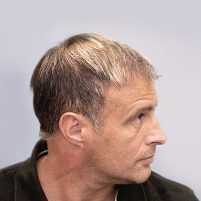 right_after