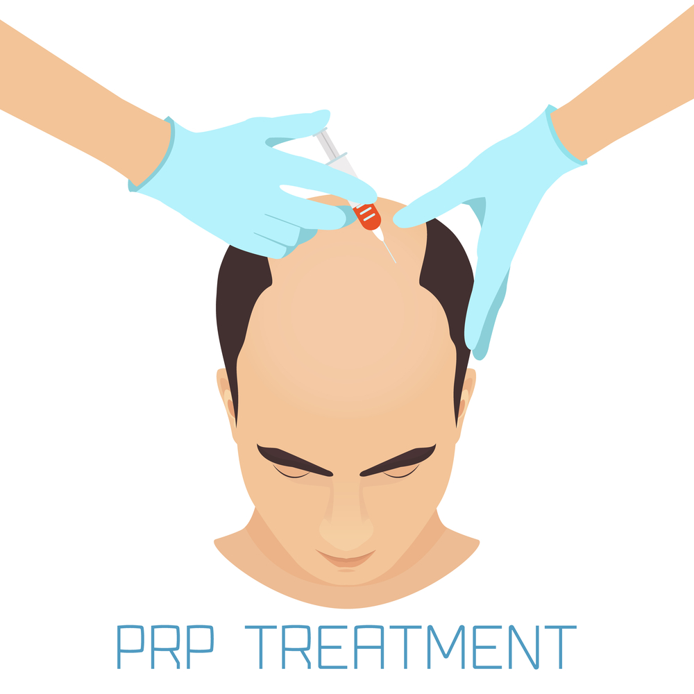 PRP (Platelet Rich Plasma) Therapy - Farjo