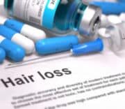 BLOG: Top 3 Treatments for Slowing Down Hair Loss