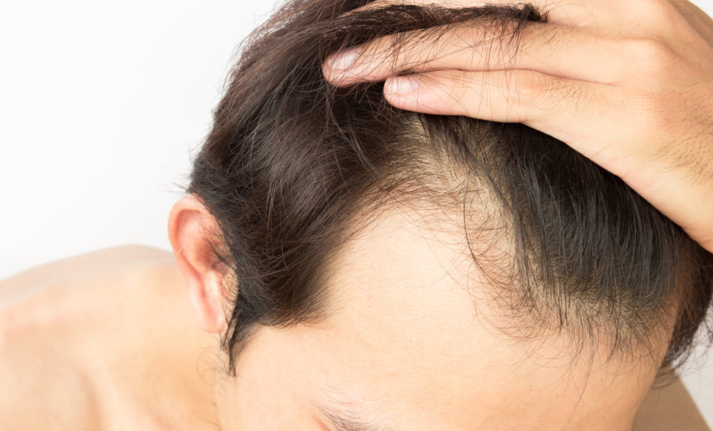 fut or fue hair transplant treatment options at Farjo Hair Institute