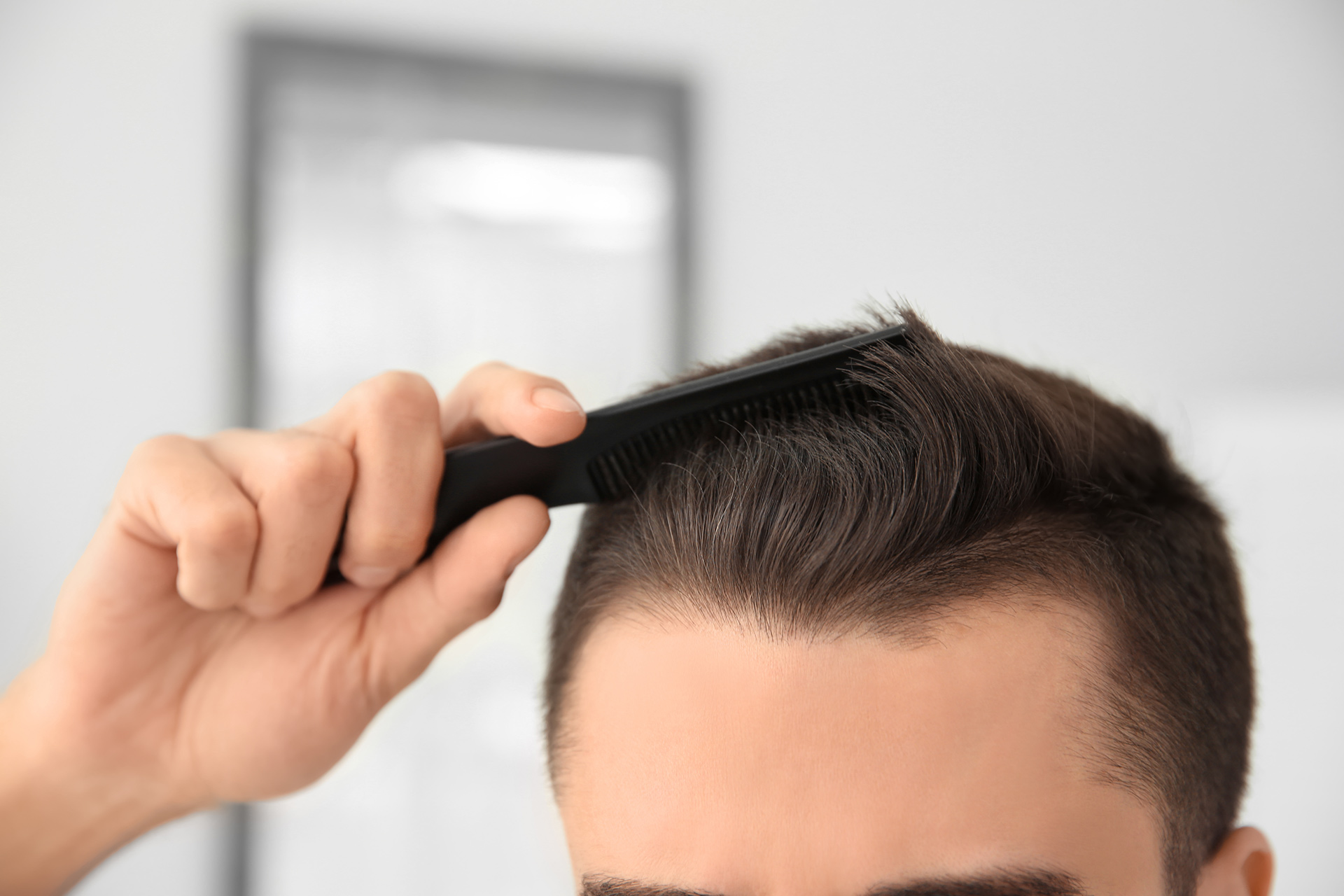 Hair Loss on Temples: Causes, Symptoms & Treatments | HairMD