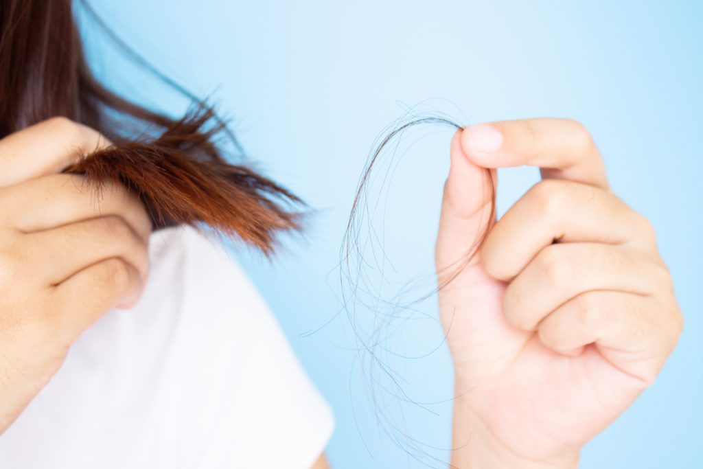 female hair loss