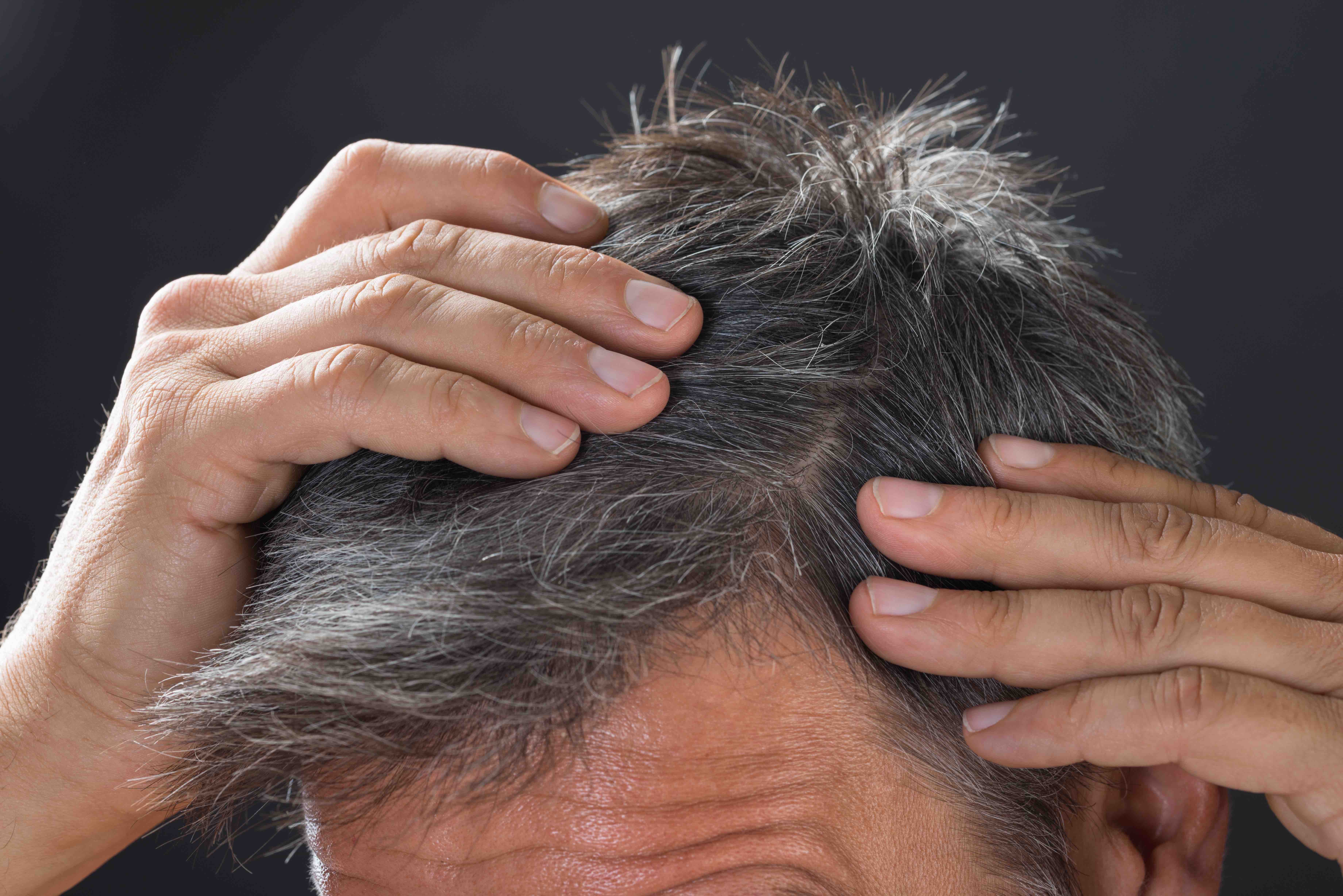 From sun to stress: what really causes hair loss? | Farjo Hair Institute