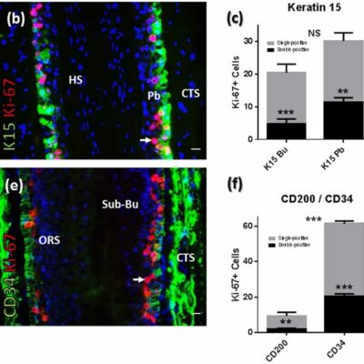 Hair Follicle Progenitor Response to Prostaglandin D2