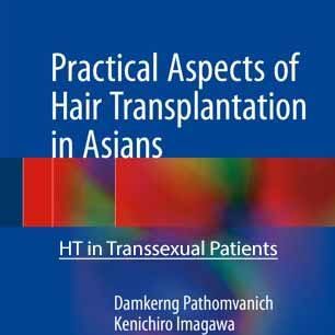 Hair Transplantation in Transsexual Patients