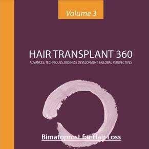 Bimatoprost for Hair Loss?