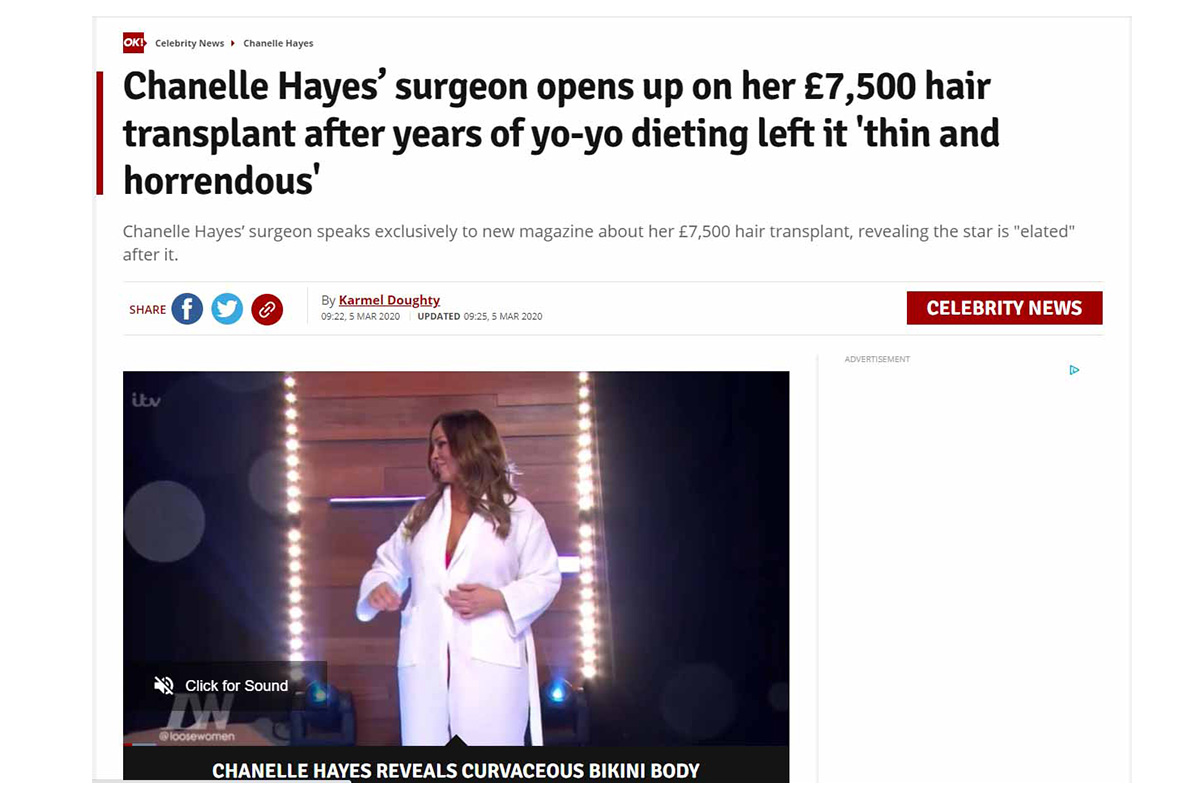 Chanelle Hayes’ surgeon opens up on her £7,500 hair transplant