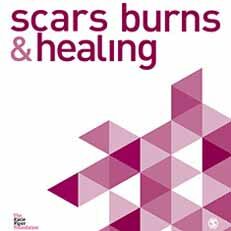 Hair Transplant Surgery in Burn Scars
