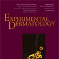 Hair Culture Limitations in Studying Minoxidil
