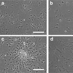 Oxidative Stress May Have a Role in Pattern Baldness