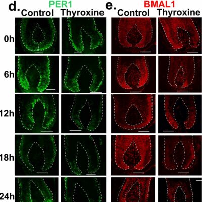 Thyroid Hormone Affects Body's Peripheral Clock