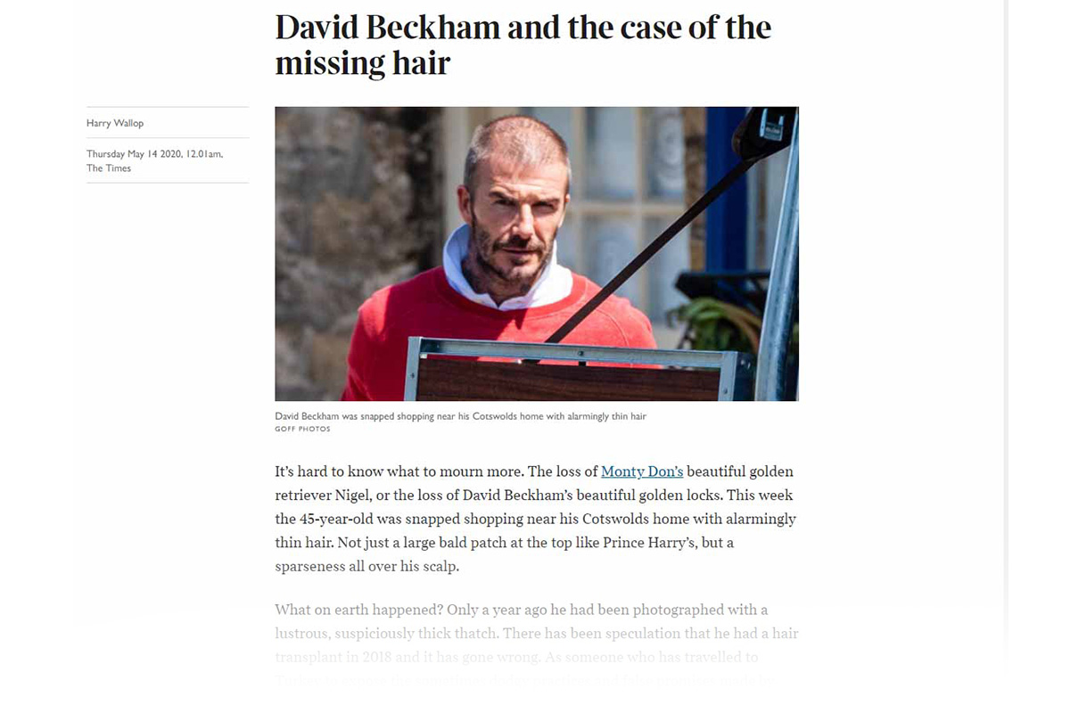 David Beckham and the case of the missing hair