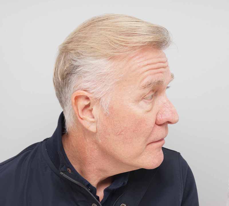 Martin Fry