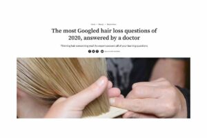 Most Googled Hair Loss Questions