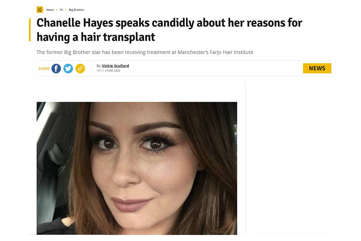 Chanelle Hayes speaks candidly about her reasons for having a hair transplant