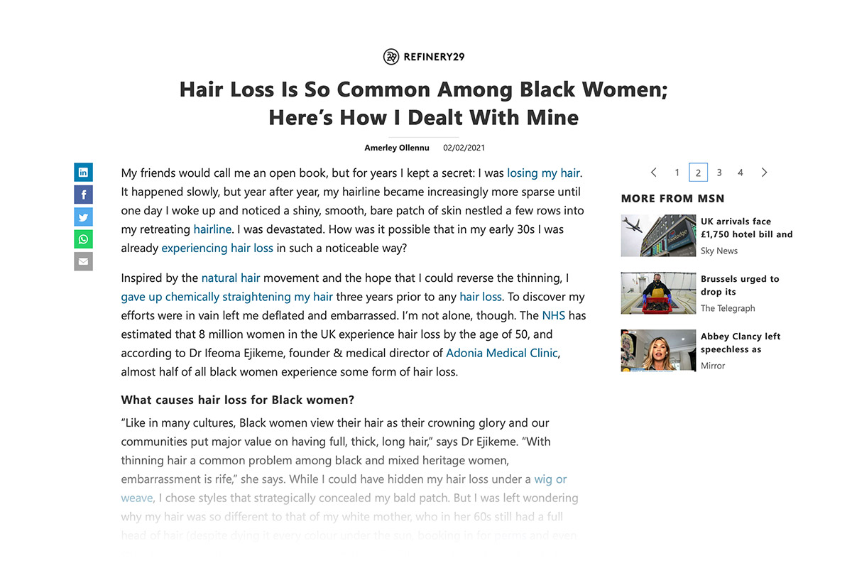 Hair loss is so common among black women; here’s how I dealt with mine