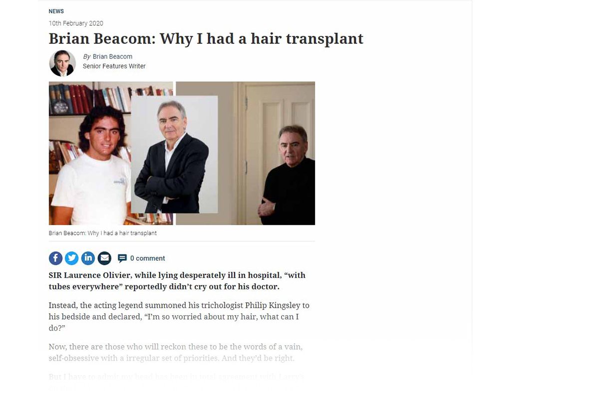 Brian Beacom: Why I had a hair transplant