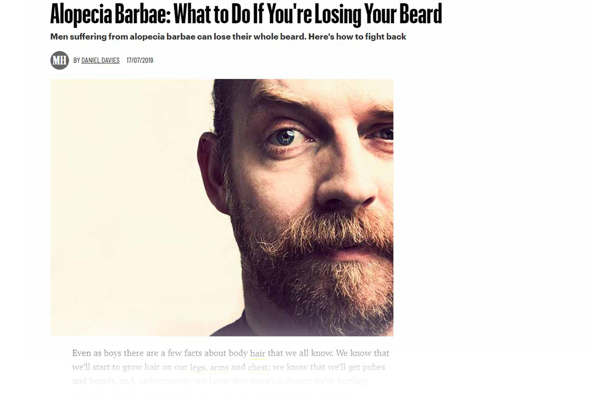 Alopecia Barbae: What to Do If You’re Losing Your Beard