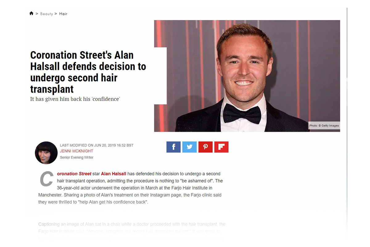 Coronation Street’s Alan Halsall defends decision to undergo second hair transplant