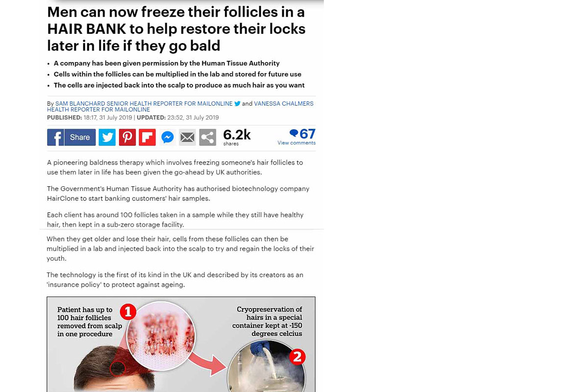 Men can now freeze their follicles in a HAIR BANK to help restore their locks later in life if they go bald