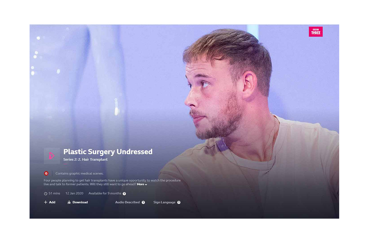 Plastic Surgery Undressed Series 2:2 Hair Transplant