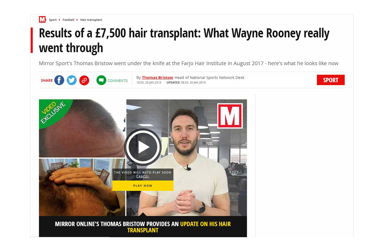 Results of a £7,500 hair transplant: What Wayne Rooney really went through