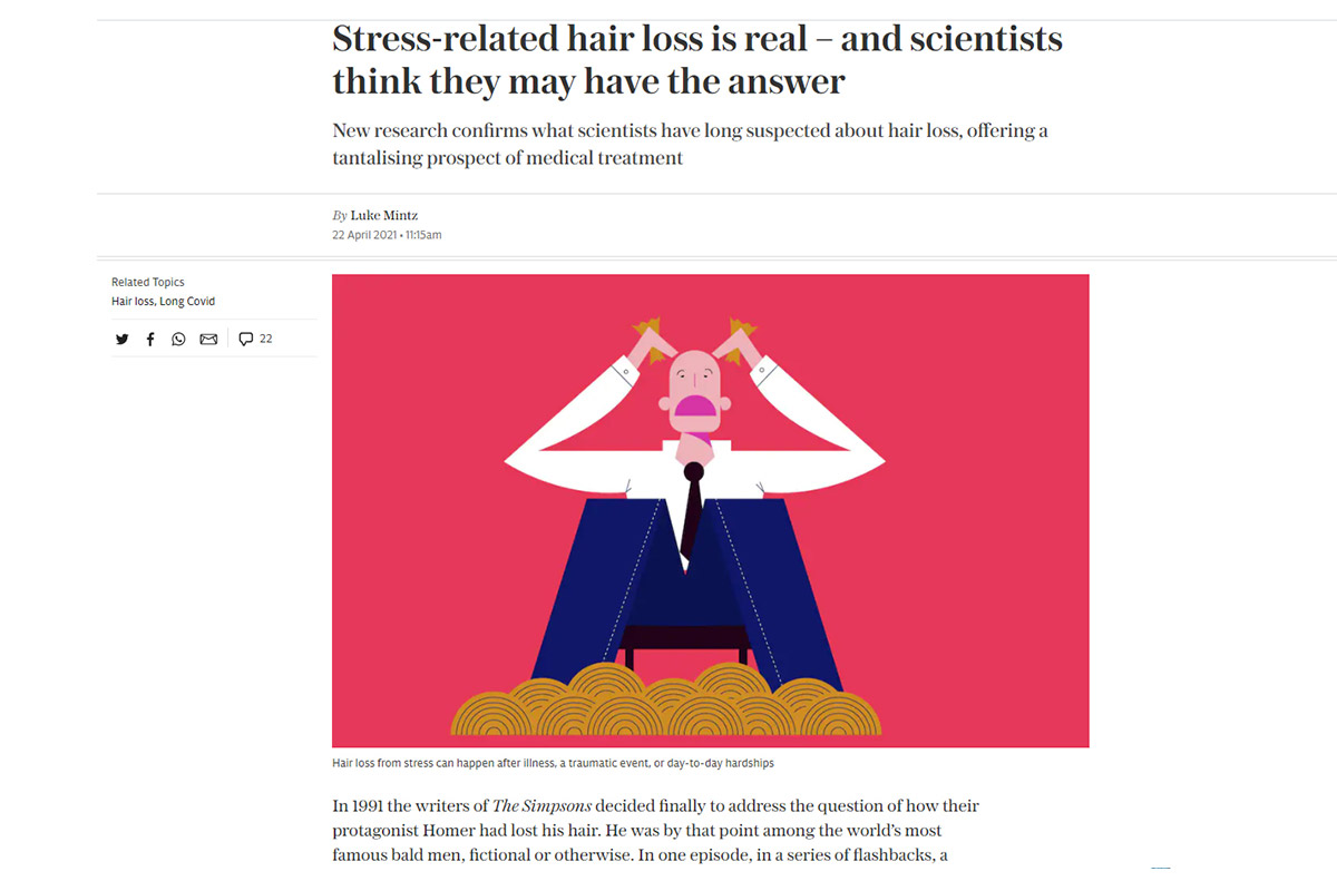 Stress-related hair loss is real – and scientists think they may have the answer