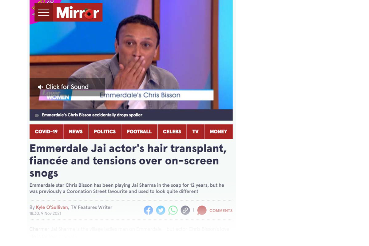 Emmerdale Jai actor’s hair transplant, fiancée and tensions over on-screen snogs