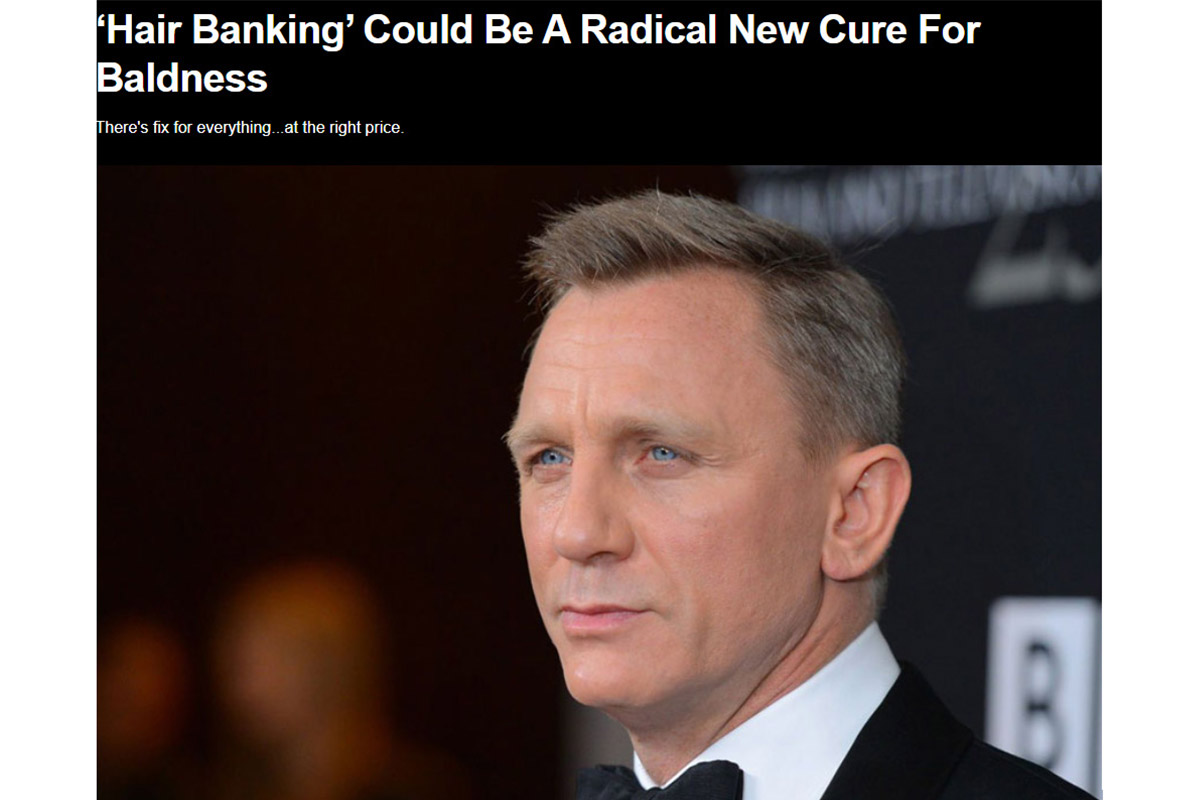 ‘Hair Banking’ Could Be A Radical New Cure For Baldness