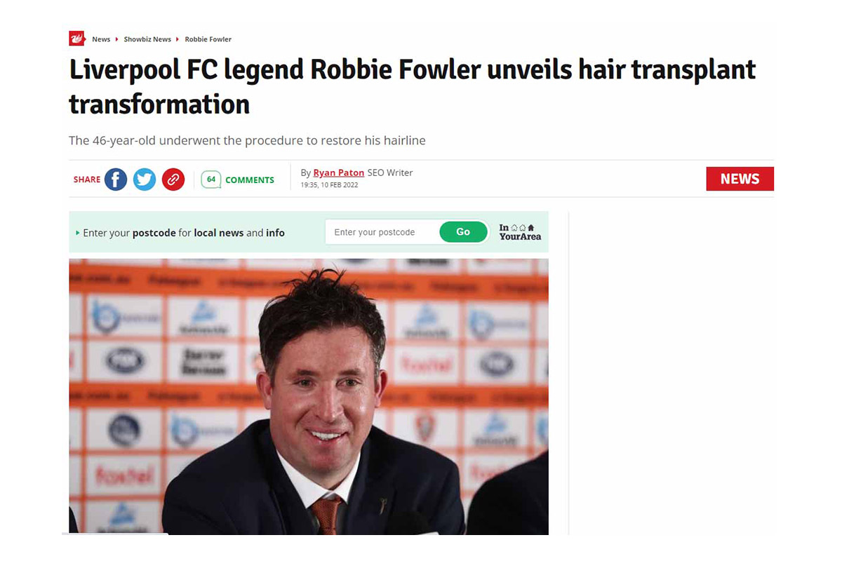 Liverpool FC legend Robbie Fowler unveils hair transplant transformation