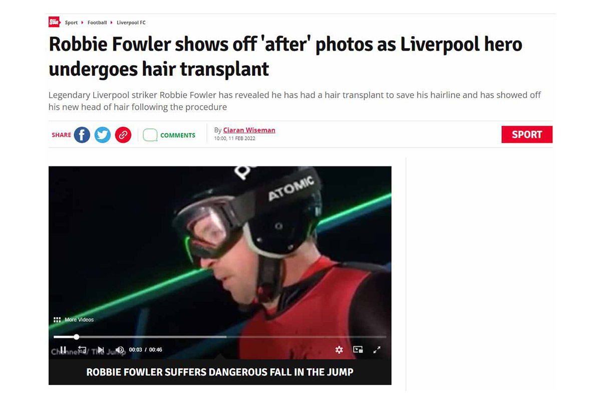 Robbie Fowler shows off after photos as Liverpool hero undergoes hair transplant