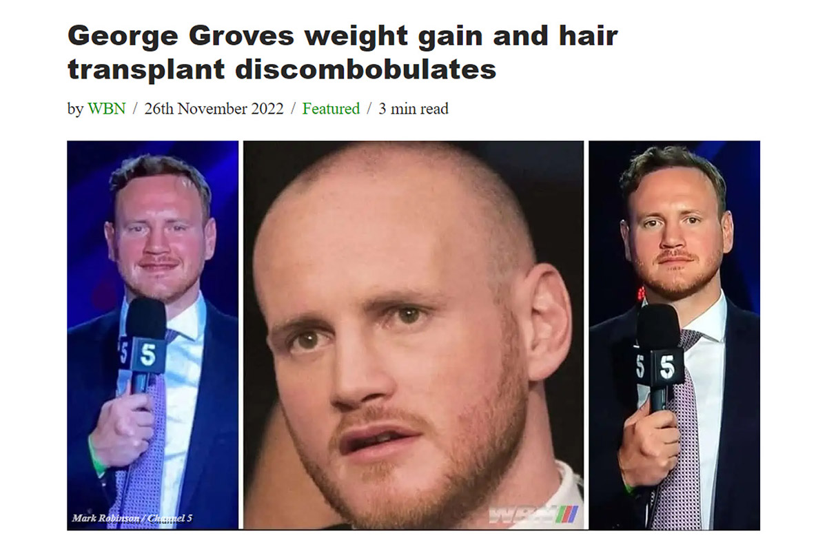 George Groves weight gain and hair transplant discombobulates