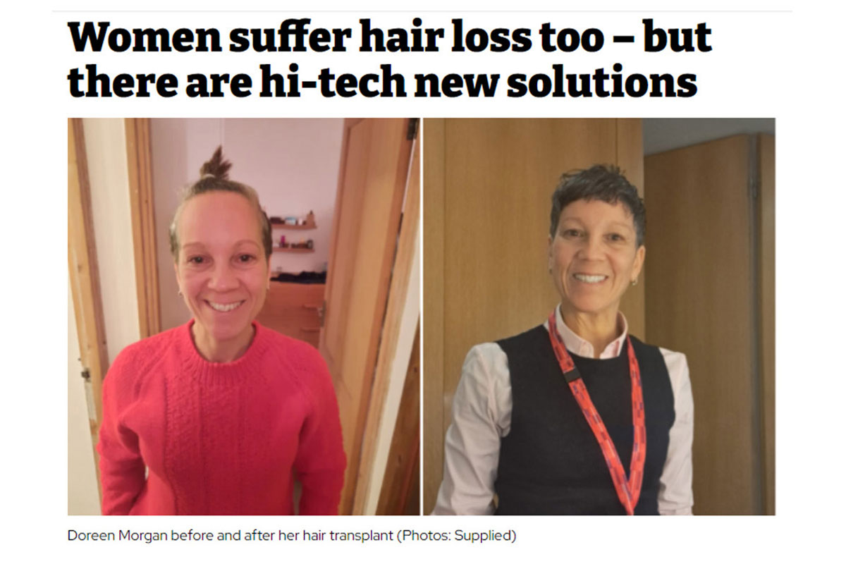 Women suffer hair loss too – but there are hi-tech new solutions