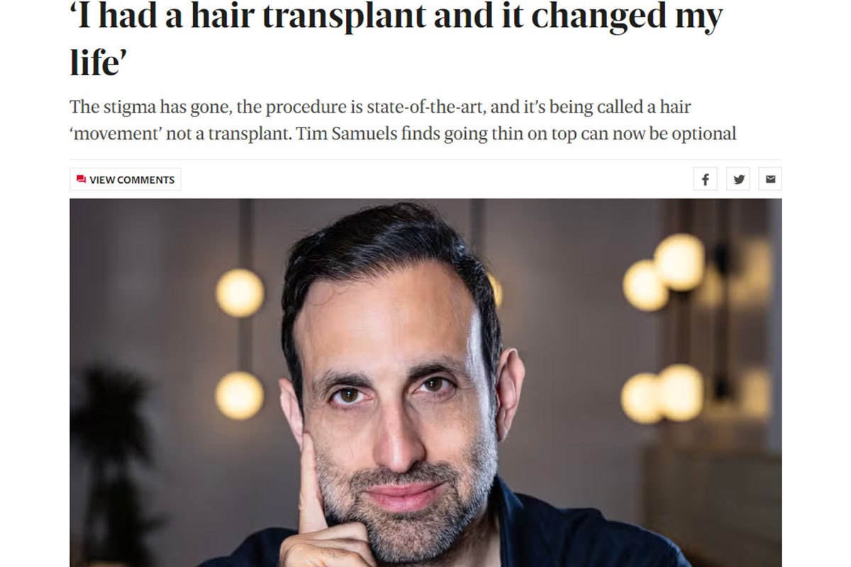 ‘I had a hair transplant and it changed my life’