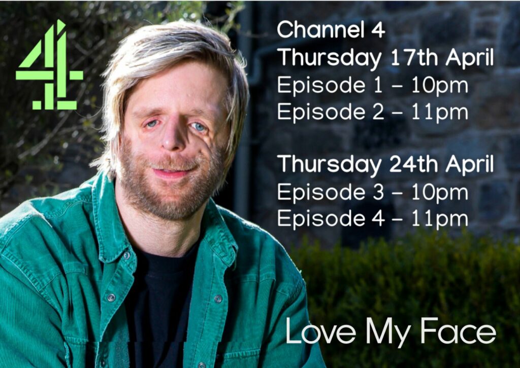 Jono Lancaster, presenter of Love My Face on Channel 4 featuring Bessam Farjo from Farjo Hair Institute